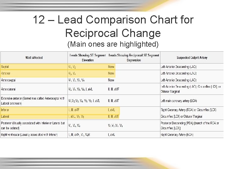 12 – Lead Comparison Chart for Reciprocal Change (Main ones are highlighted) 