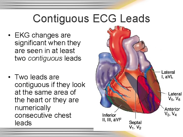 Contiguous ECG Leads • EKG changes are significant when they are seen in at
