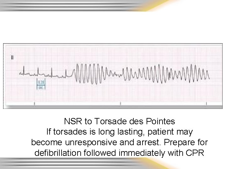 NSR to Torsade des Pointes If torsades is long lasting, patient may become unresponsive