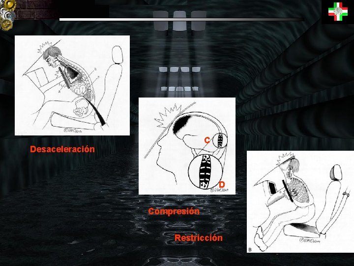 C Desaceleración D Compresión Restricción 