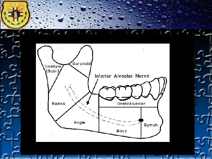 TRAUMA FACIAL 