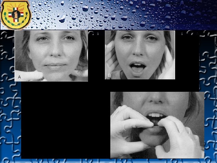TRAUMA FACIAL TRAUMA FACIAL