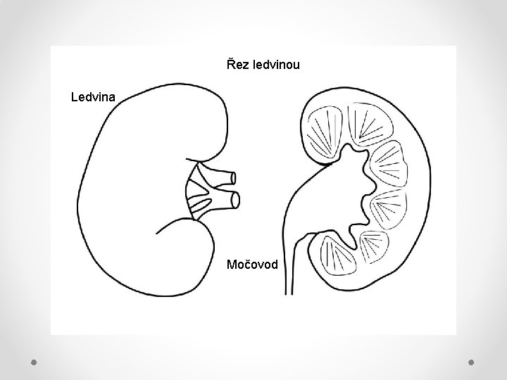 Řez ledvinou Ledvina Močovod 