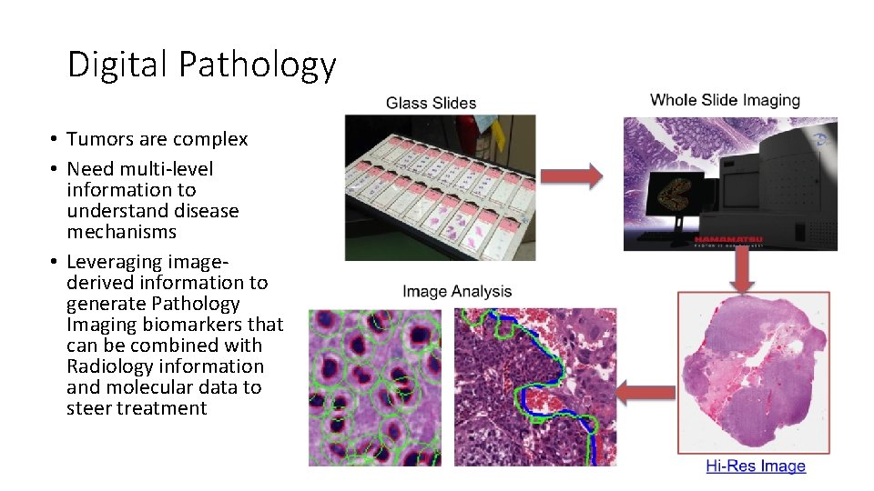 Digital Pathology • Tumors are complex • Need multi-level information to understand disease mechanisms Digital Pathology • Tumors are complex • Need multi-level information to understand disease mechanisms