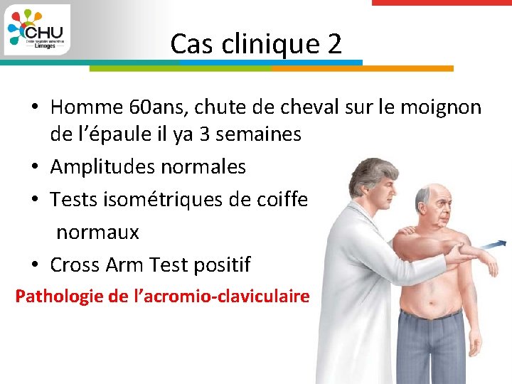 Cas clinique 2 • Homme 60 ans, chute de cheval sur le moignon de