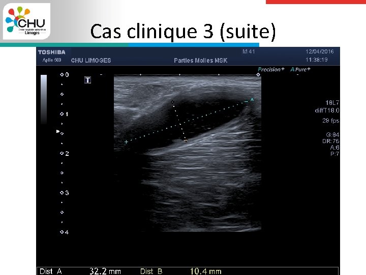 Cas clinique 3 (suite) 