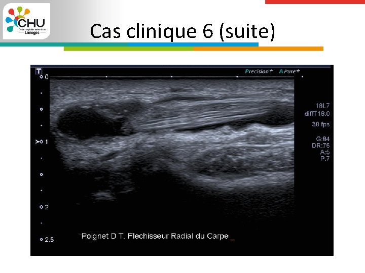 Cas clinique 6 (suite) 