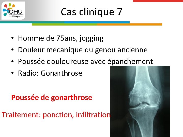 Cas clinique 7 • • Homme de 75 ans, jogging Douleur mécanique du genou