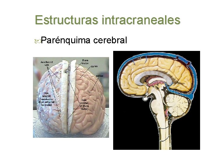 Estructuras intracraneales Parénquima cerebral 