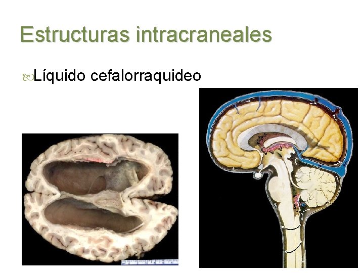 Estructuras intracraneales Líquido cefalorraquideo 