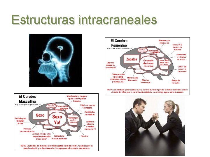 Estructuras intracraneales 