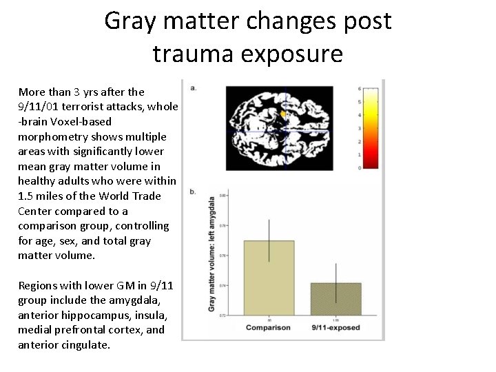 Gray matter changes post trauma exposure More than 3 yrs after the 9/11/01 terrorist