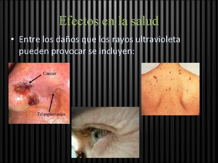Efectos en la salud • Entre los daños que los rayos ultravioleta pueden provocar