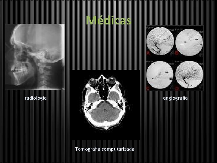 Médicas radiología angiografía Tomografía computarizada 