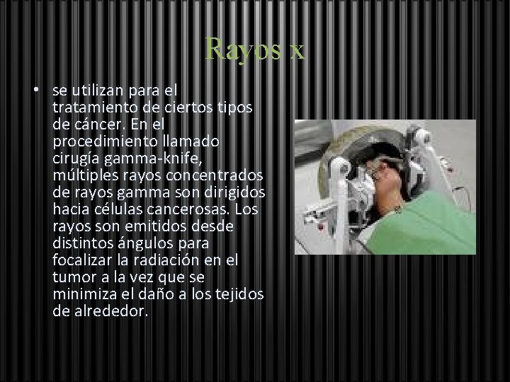 Rayos x • se utilizan para el tratamiento de ciertos tipos de cáncer. En