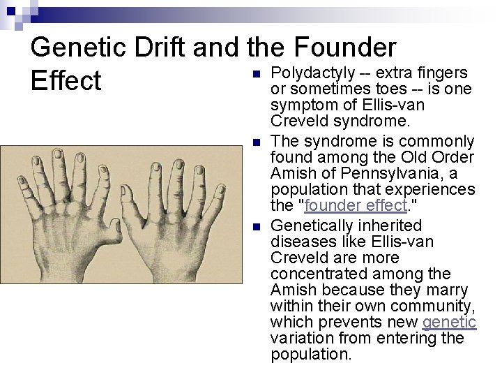 Genetic Drift and the Founder n Polydactyly -- extra fingers Effect or sometimes toes Genetic Drift and the Founder n Polydactyly -- extra fingers Effect or sometimes toes