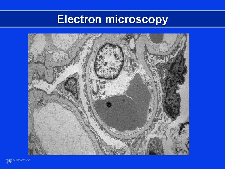 Electron microscopy 