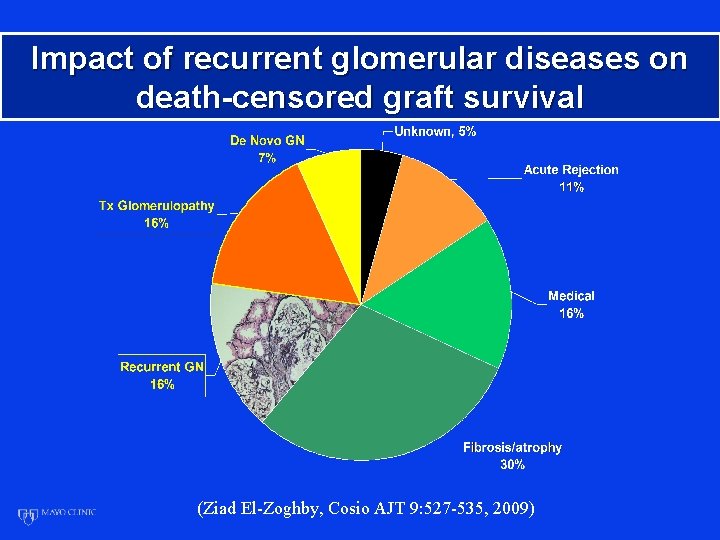 Impact of recurrent glomerular diseases on death-censored graft survival (Ziad El-Zoghby, Cosio AJT 9: