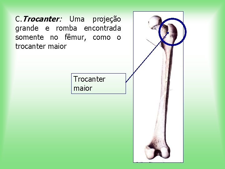 C. Trocanter: Uma projeção grande e romba encontrada somente no fêmur, como o trocanter