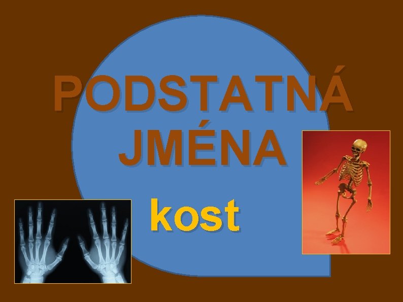 PODSTATNÁ JMÉNA kost 