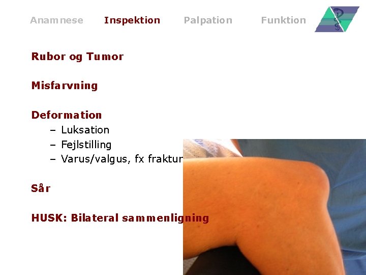 Anamnese Inspektion Palpation Rubor og Tumor Misfarvning Deformation – Luksation – Fejlstilling – Varus/valgus,