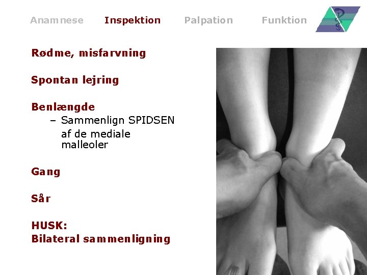 Anamnese Inspektion Rødme, misfarvning Spontan lejring Benlængde – Sammenlign SPIDSEN af de mediale malleoler