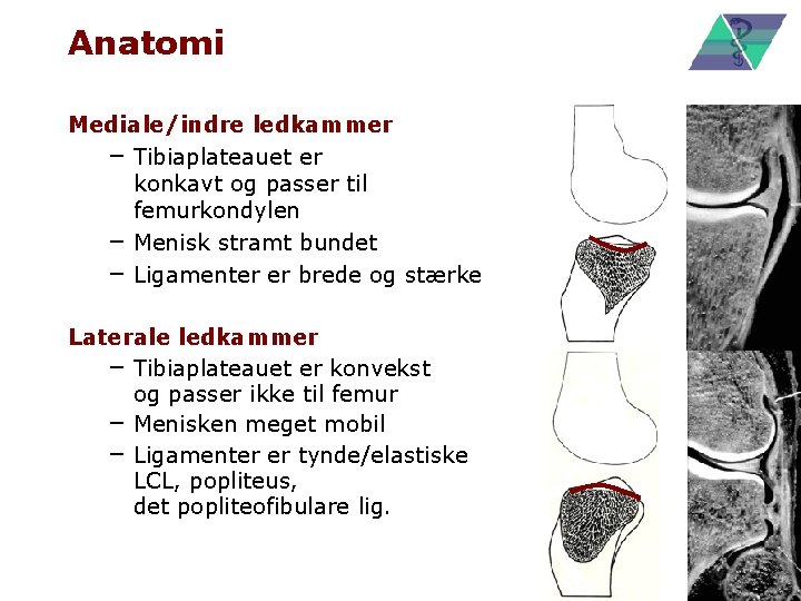 Anatomi Mediale/indre ledkammer – Tibiaplateauet er konkavt og passer til femurkondylen – Menisk stramt