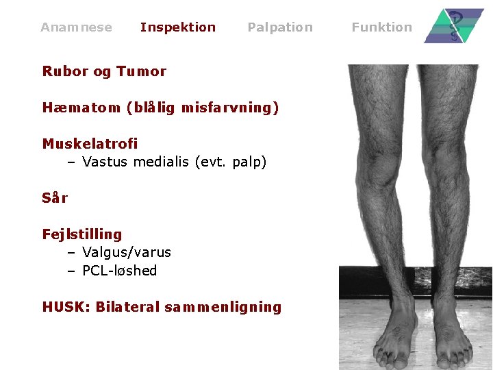 Anamnese Inspektion Palpation Rubor og Tumor Hæmatom (blålig misfarvning) Muskelatrofi – Vastus medialis (evt.