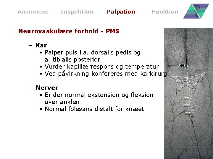 Anamnese Inspektion Palpation Funktion Neurovaskulære forhold - PMS – Kar • Palper puls i