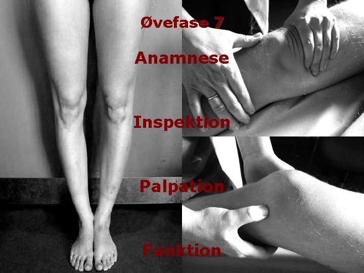 Øvefase 7 Anamnese Inspektion Palpation Funktion 