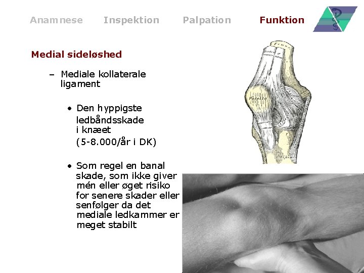 Anamnese Inspektion Medial sideløshed – Mediale kollaterale ligament • Den hyppigste ledbåndsskade i knæet