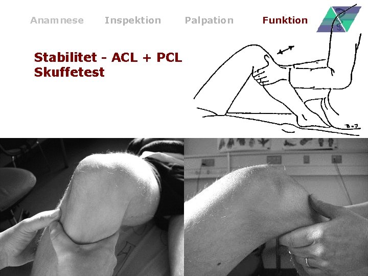 Anamnese Inspektion Stabilitet - ACL + PCL Skuffetest Palpation Funktion 