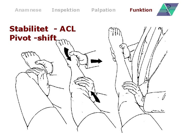 Anamnese Inspektion Stabilitet - ACL Pivot -shift Palpation Funktion 