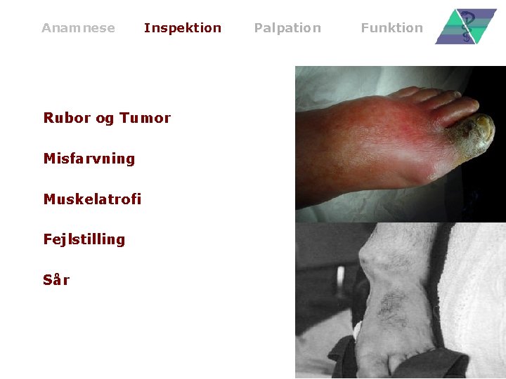 Anamnese Inspektion Rubor og Tumor Misfarvning Muskelatrofi Fejlstilling Sår Palpation Funktion 