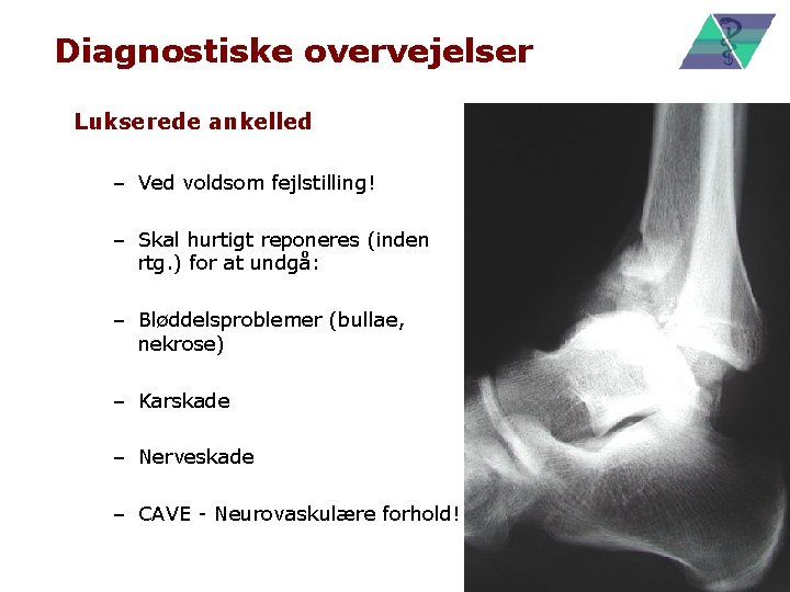 Diagnostiske overvejelser Lukserede ankelled – Ved voldsom fejlstilling! – Skal hurtigt reponeres (inden rtg.