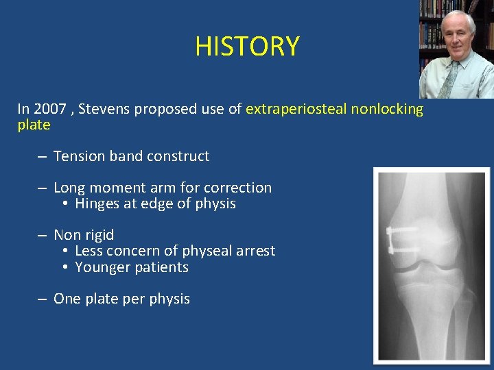 HISTORY In 2007 , Stevens proposed use of extraperiosteal nonlocking plate – Tension band