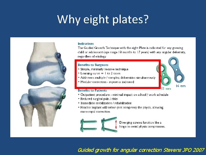 Why eight plates? Guided growth for angular correction Stevens JPO 2007 