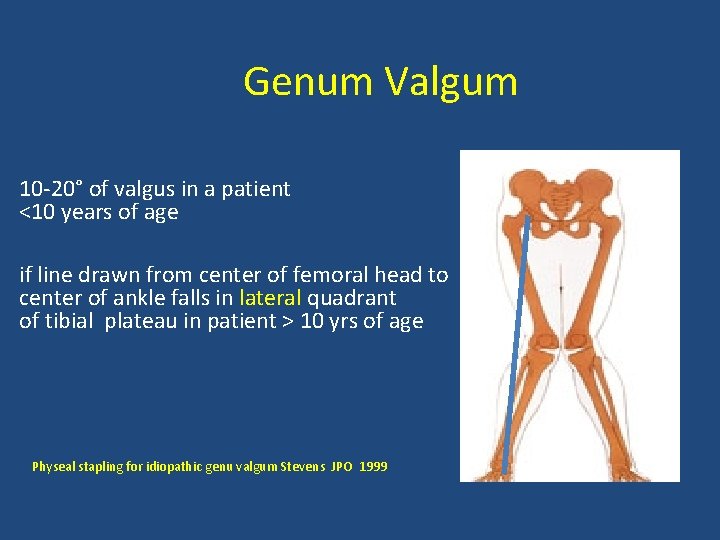 Genum Valgum 10 -20° of valgus in a patient <10 years of age if