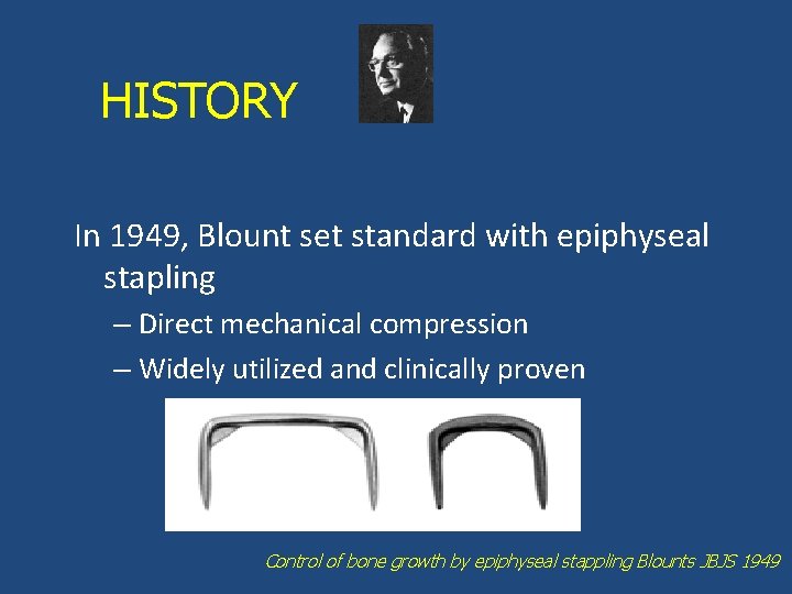 HISTORY In 1949, Blount set standard with epiphyseal stapling – Direct mechanical compression –