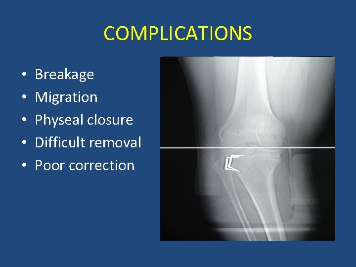 COMPLICATIONS • • • Breakage Migration Physeal closure Difficult removal Poor correction 