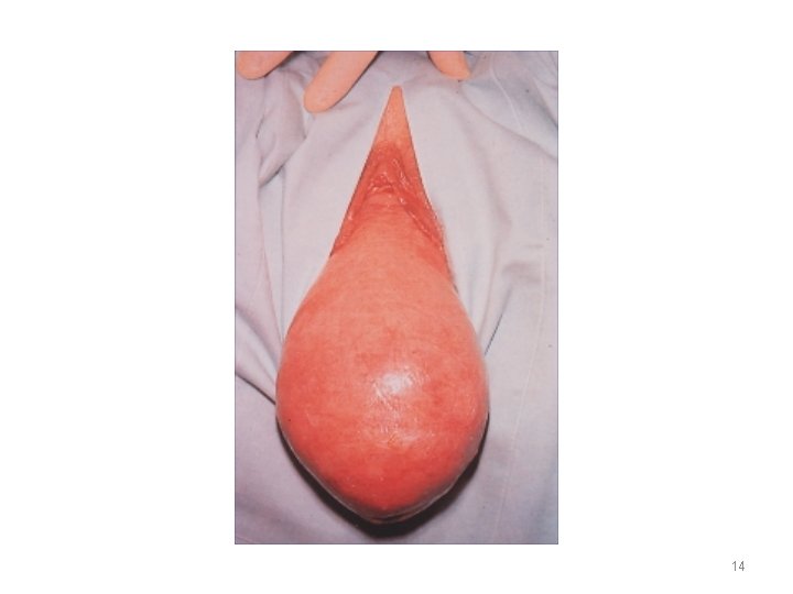 14 