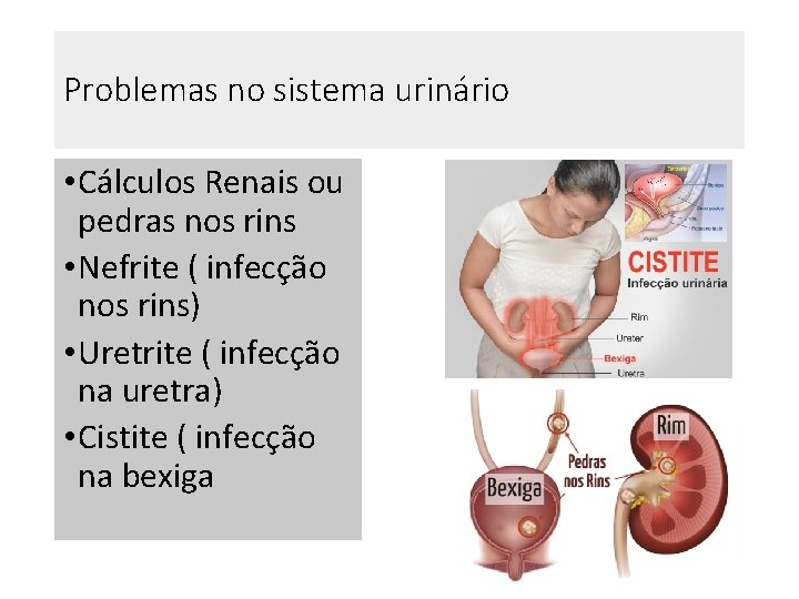 Problemas no sistema urinário • Cálculos Renais ou pedras nos rins • Nefrite ( Problemas no sistema urinário • Cálculos Renais ou pedras nos rins • Nefrite (