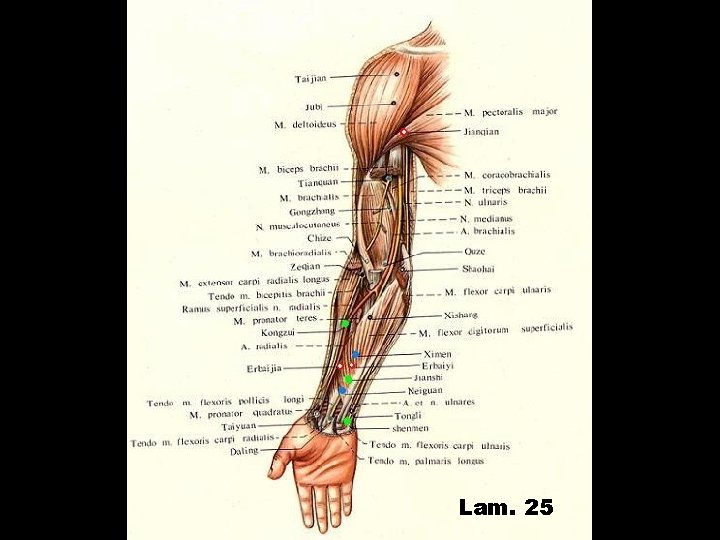 Lam. 25 