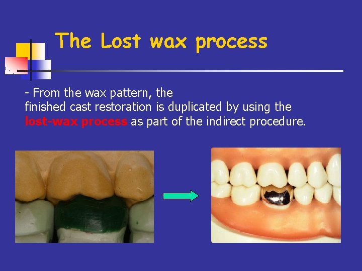 The Lost wax process - From the wax pattern, the finished cast restoration is