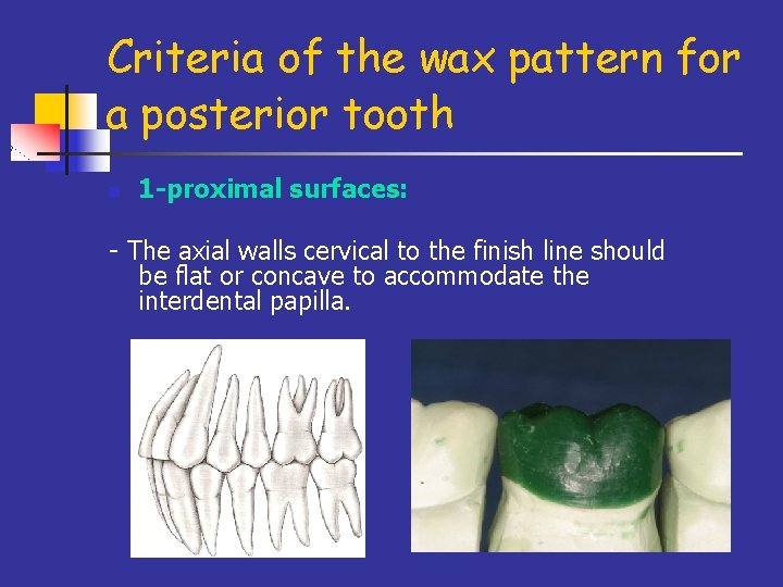 Criteria of the wax pattern for a posterior tooth n 1 -proximal surfaces: -