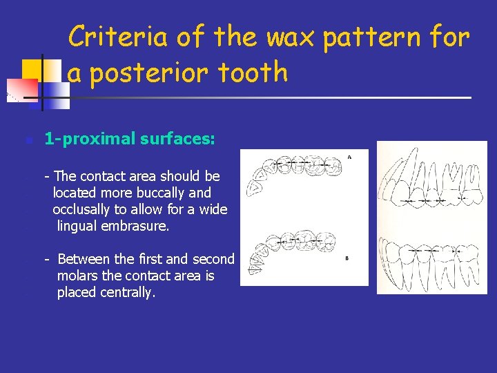 Criteria of the wax pattern for a posterior tooth n - - 1 -proximal