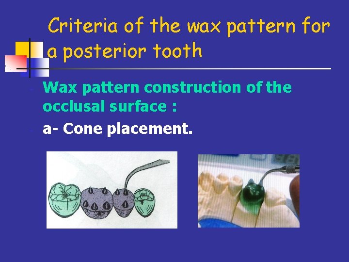 Criteria of the wax pattern for a posterior tooth - - Wax pattern construction