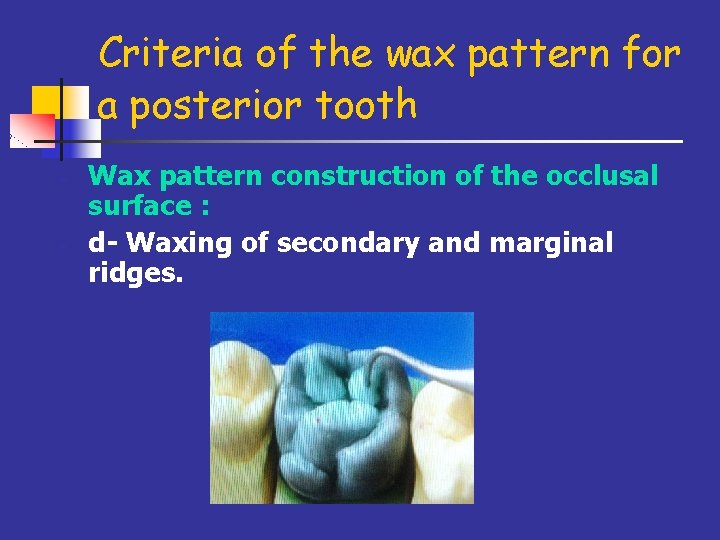 Criteria of the wax pattern for a posterior tooth - - Wax pattern construction