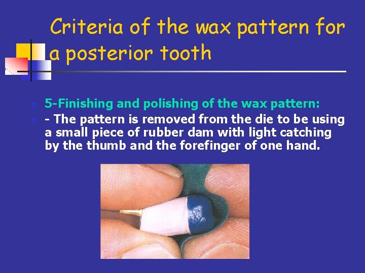Criteria of the wax pattern for a posterior tooth n n 5 -Finishing and