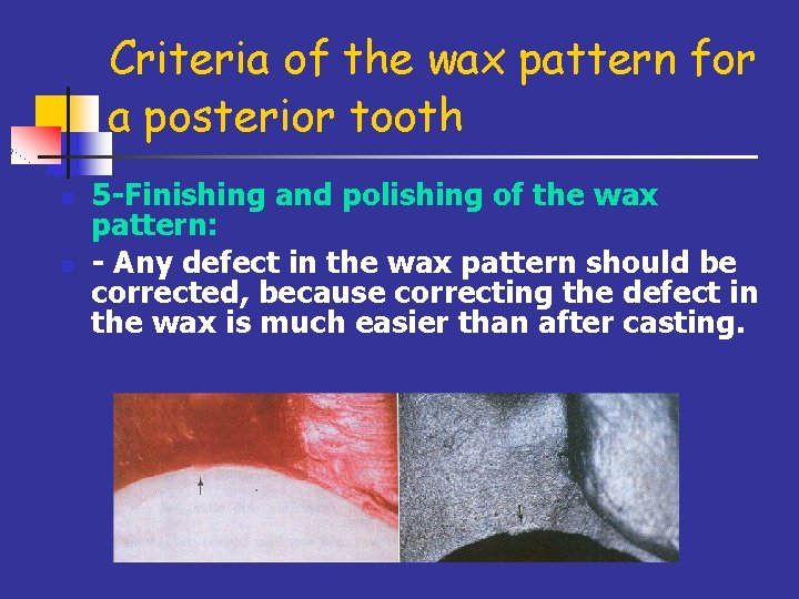 Criteria of the wax pattern for a posterior tooth n n 5 -Finishing and